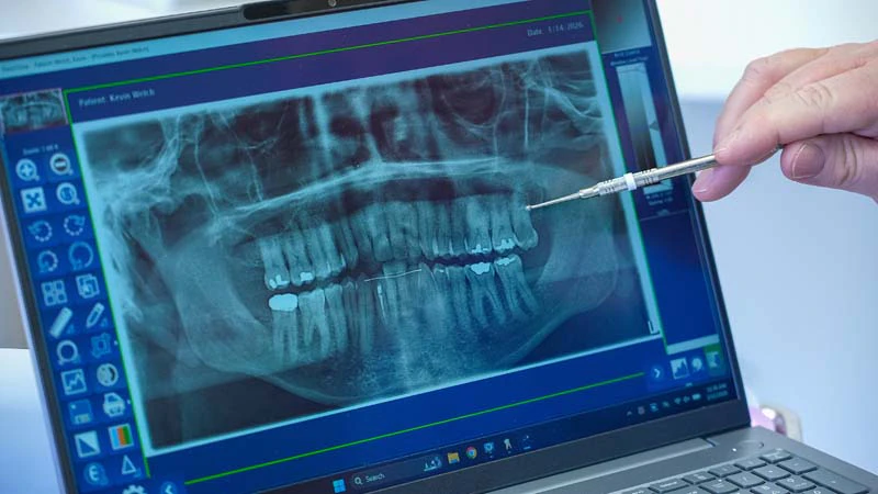 Digital X-ray while the doctor discusses oral surgery options of Family Practice Dentistry in Kokomo IN.