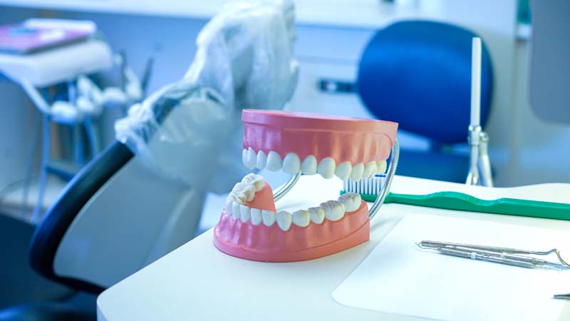 a 3D model of teeth on the counter at Family Dental Practice in Kokomo IN.